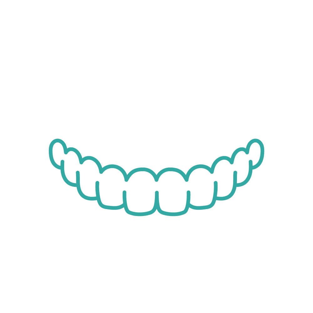 Dental Sourire Alès | Goutière