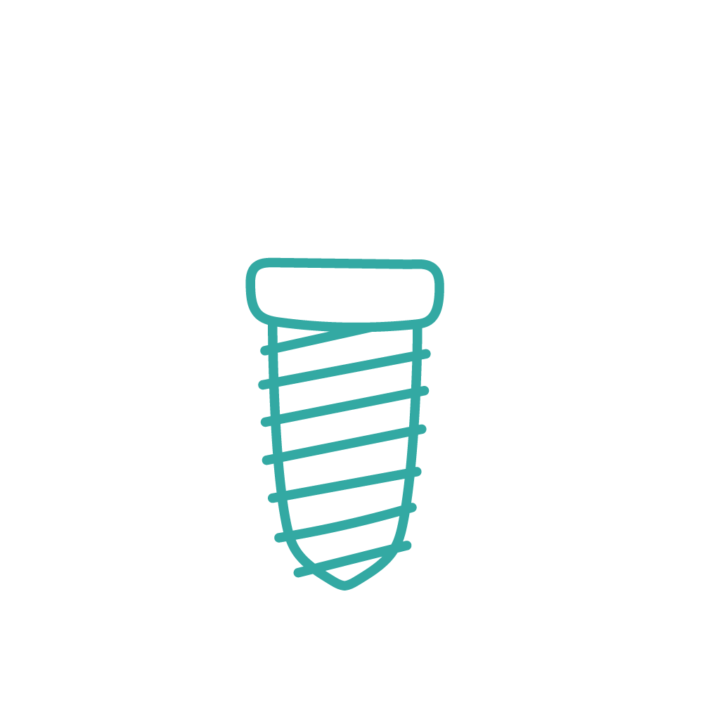 Implants Dentaires à Alès | Dental Sourire