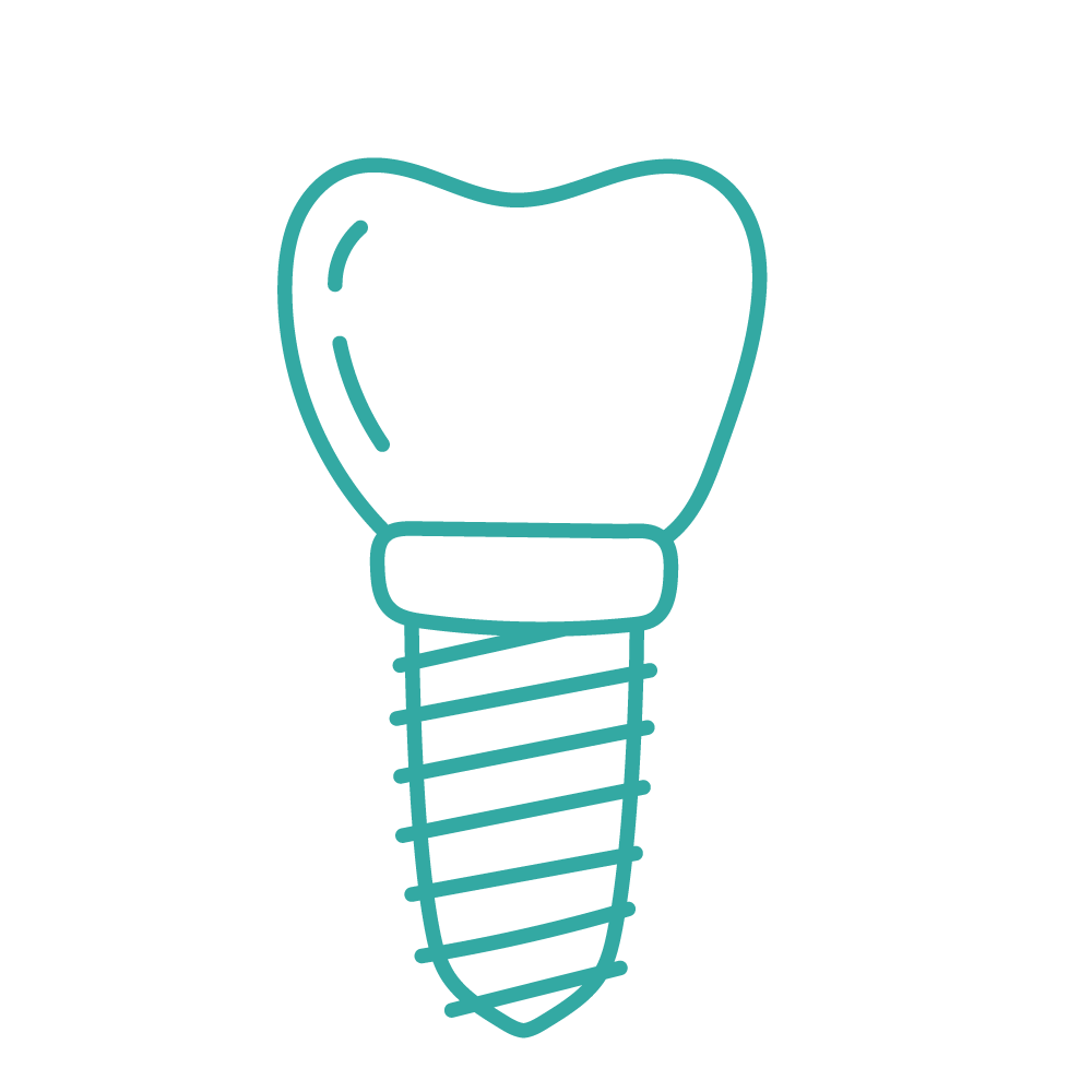 Implants Dentaires à Alès | Dental Sourire